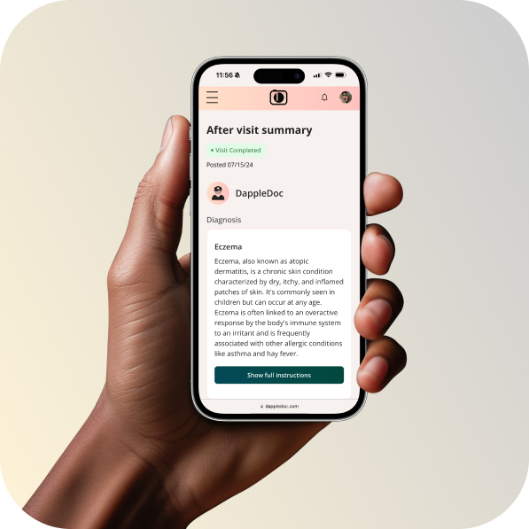 Mobile app showing diagnosis summary for eczema